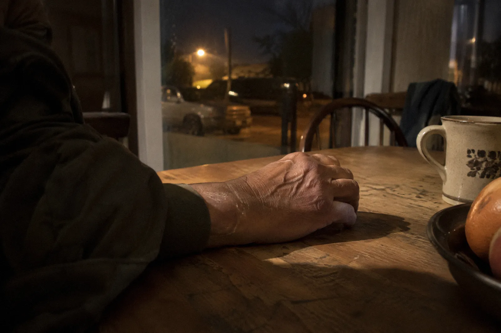 An older healed scar on the back of a hand resting on a table, natural window light, respectful
