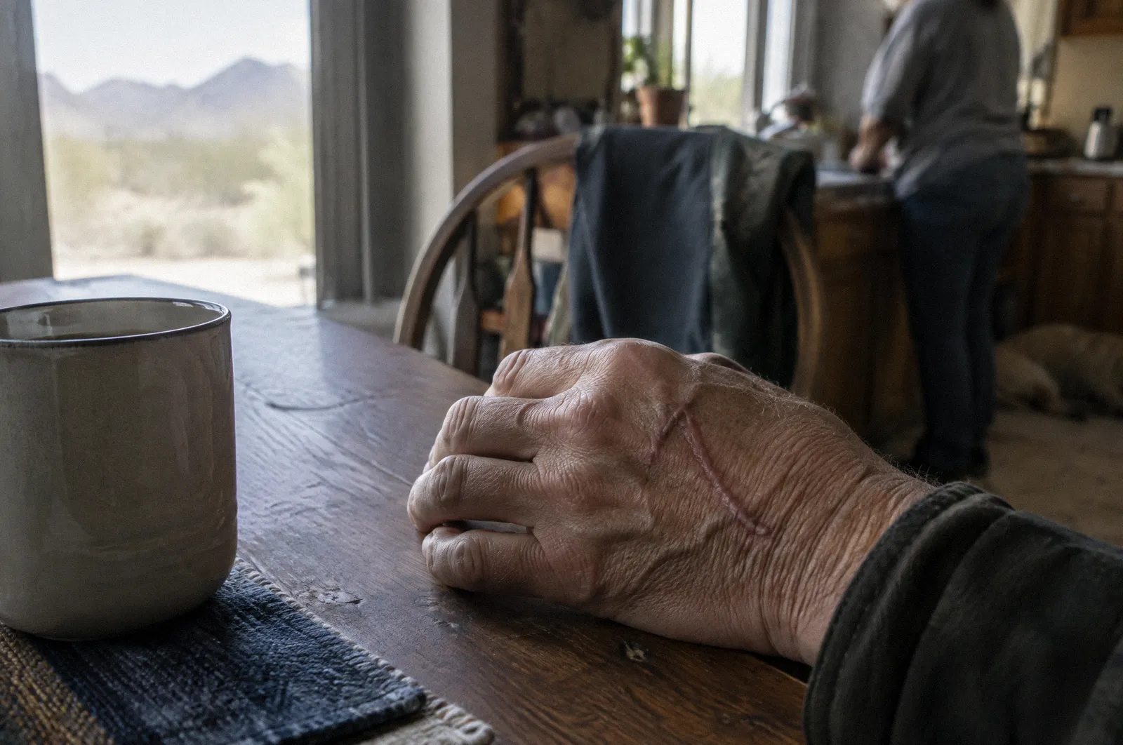 An older healed scar on the back of a hand resting on a table, natural window light, respectful