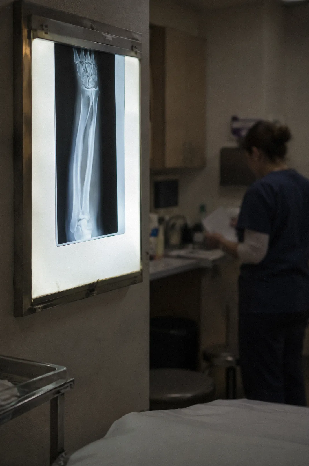 An x-ray of a forearm on a light viewer in a dim exam room, out-of-focus clinician in the background